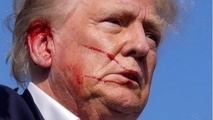 ترامپ؛ برنده کارزار ترور نافرجام/ حادثه واقعی یا ساختگی؟!