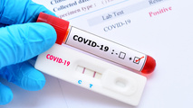Travelers faking COVID-19 test results to fly